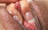 Large clitoris